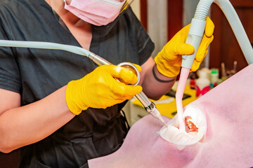 Dentistry. Professional dentist does hardware teeth cleaning with Air Flow for a patient....