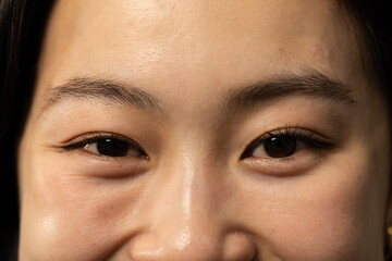 Asian woman presenting skin texture and defined eye area under warm lighting against dark backdrop