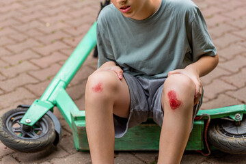 Boy worried about leg injury. child injured his knee when he fell off the scooter. Blood and...
