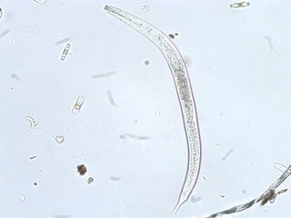 Nematode unter dem Mikroskop (200x/Hellfeld)