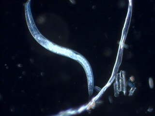 Nematode unter dem Mikroskop (200x/Dunkelfeld)