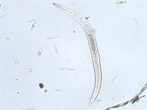 Nematode unter dem Mikroskop (200x/Hellfeld)