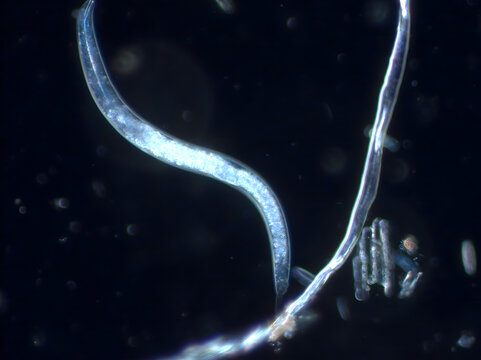 Nematode unter dem Mikroskop (200x/Dunkelfeld)
