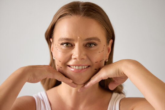 Anti-aging solutions. Mature woman with cosmetic surgery marks smiling and posing with hands near chin. Concept of aesthetic procedures, confidence, beauty marketing, aging, and wellness themes.