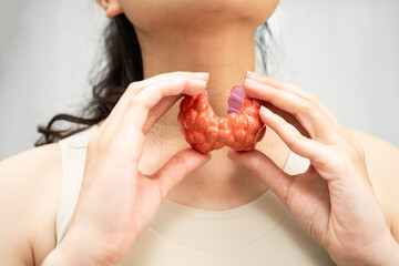 Hyperthyroidism, Overactive Thyroid, Thyroid Lymphoma, Asian woman with thyroid gland human anatomy model.