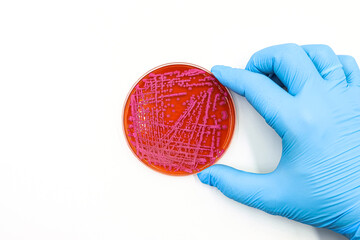 Microbiology. Laboratory Petri dish with pink colonies of yeast. Space for text.