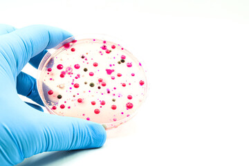 Microbiological culture with colonies of bacteria, fungi and yeasts.