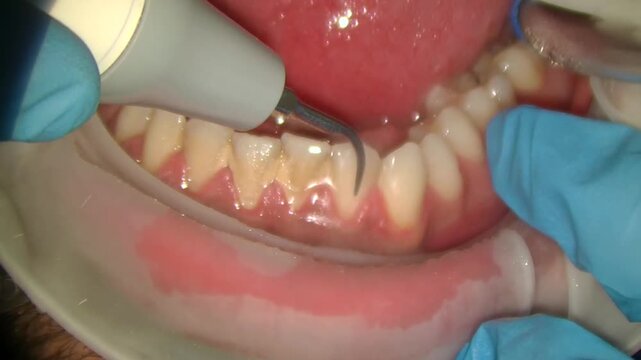 teeth cleaning