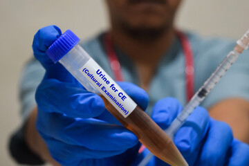 Text Urine for CE - Cultural Examination of is written on a bottle sample with background of a doctor with a syringe in a medical glove mask. Medical 