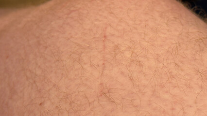 Extreme macro of natural caucasian skin texture with vellus hairs and follicles