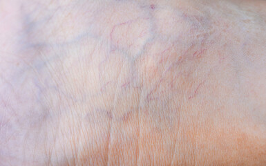 Capillaries on the human body.