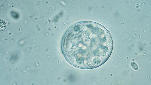 Bell-shaped ciliate vorticella under microscope in action