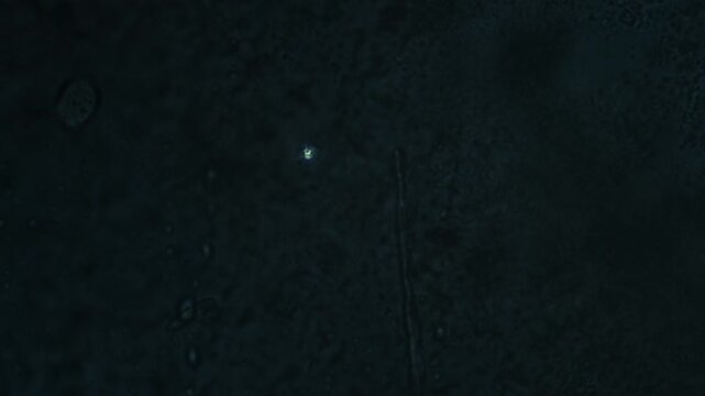 A single paramecium under microscope in polarized light with visible internal bright crystaline elements