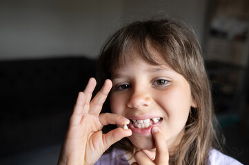 Girl holding a tiny lost tooth.