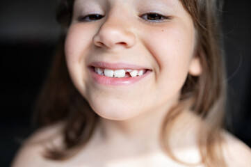 Close-up portrait of smiling girl with missing milk tooth.