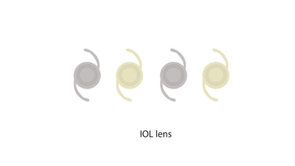 眼科検査と視能訓練士の仕事、眼鏡処方、レンズ検査・視力測定・点眼指導