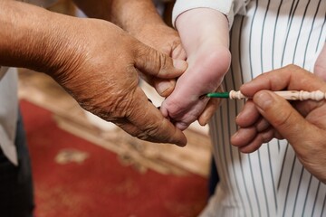 Traditional Male Circumcision Ritual with Cotton Swab. Hands Gently Applying Antiseptic During Islamic Aqiqah Ceremony, Brown Skin Tone.