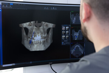 Detailed 3D Imaging of a Dental Structure on a Computer Screen with User Observing for Analysis in a Modern Dental Practice Environment