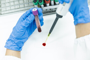 Selective focus doctor or lab technician hand wear blue gloves drip human red blood on slide for...