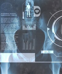 Medical interface on xray