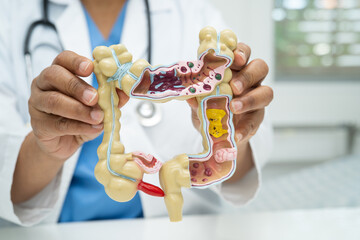 Intestine, appendix and digestive system, doctor holding anatomy model for study diagnosis and...