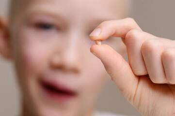 Child holds fallen baby tooth in his hands, looking at it, close-up. Children's dentistry, care of...