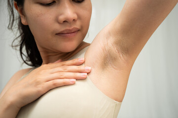 Asian woman have problem black armpit beauty skin care.