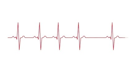 A red heartbeat line isolated on white background shows a normal rhythm