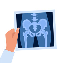 XRayBonesDoctorHand2-02.eps
