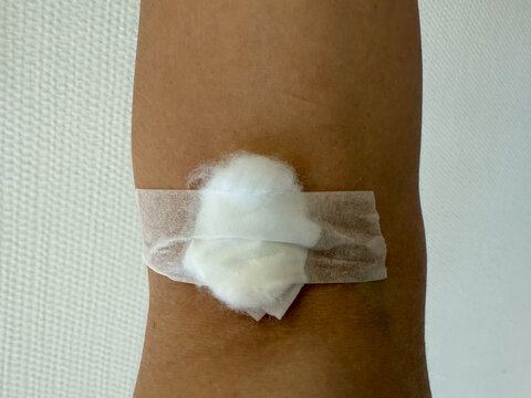 Arm of man has cotton swab to close the wound after blood test. Cotton ball with plaster cover skin from intravenous injection at vein. Blood donor with bandage after giving blood. World donor day.