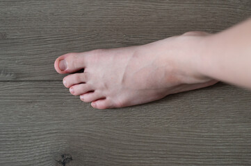 A child's feet with nibbled nails. Neurology