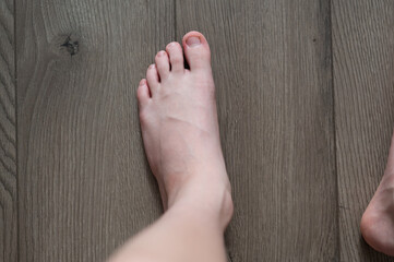A child's feet with nibbled nails. Neurology