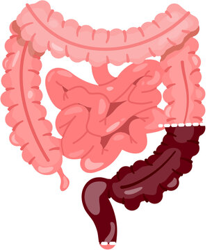 Low Anterior Resection