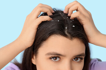 Naklejka premium Young woman with dandruff problem scratching head on blue background, closeup