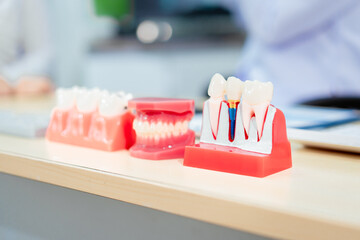 Dental tools and educational models neatly arranged on a table, including jaw and tooth decay models, patient forms, a laptop, and a compact portable dental kit for clinical or teaching purposes