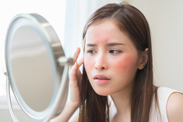 Dermatology, scratch asian young woman looking at mirror, expression worry and itch, itchy allergy...