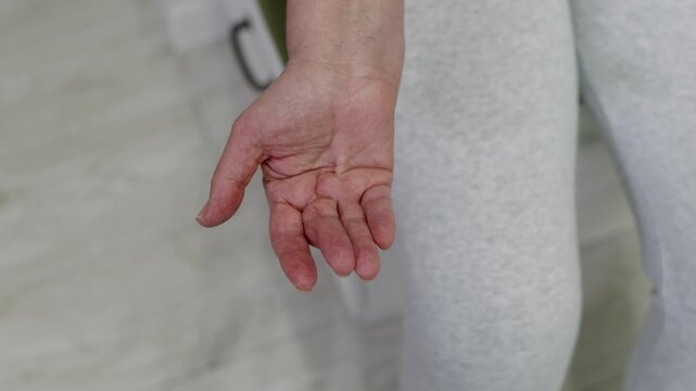 Senior woman demonstrating shortening of tendons Contracture at open hand movement, revealing various perspectives of natural aging process and wellness, highlighting healthcare resilience