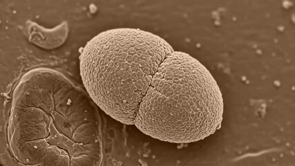 Micro image of parasitic worm egg (Ascaris or hookworm) with thick, textured shell on fecal smear slide