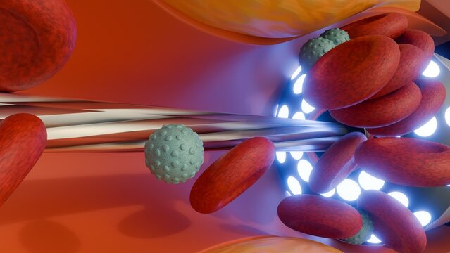 A 3d rendering of visualization of a laser atherectomy device operating within an artery, surrounded by red blood cells.