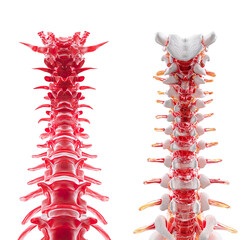 3d Rendered Illustration of Pain in the Human Spinal on Transparent Background.