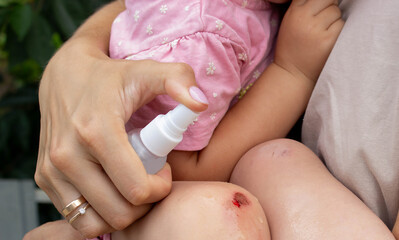 Treating Child's Scraped Knee with Antiseptic