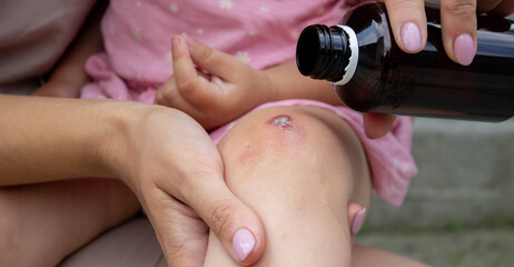 Treating Child's Scraped Knee with Antiseptic