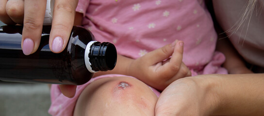 Treating Child's Scraped Knee with Antiseptic