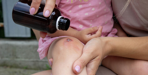 Treating Child's Scraped Knee with Antiseptic