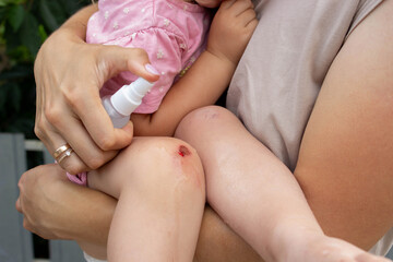 Treating Child's Scraped Knee with Antiseptic