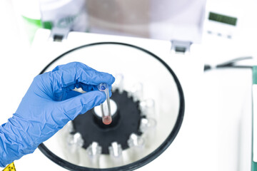 Scientist hand wear blue gloves holding glass blood test tube and reagent into the centrifuge for...