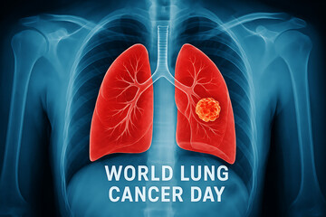World lung cancer day concept with x-ray image of lungs and visible tumor, medical awareness and prevention illustration