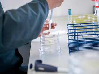 Scientist using pipette to transfer samples into stacked petri dishes for microbiological testing