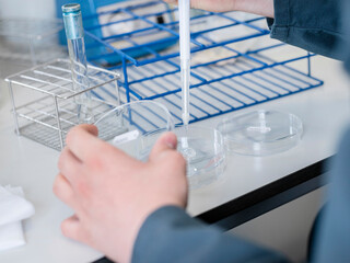 Laboratory worker pipetting liquid samples into test tubes with petri dishes for bacterial culture