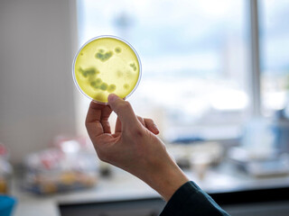 Hand displaying yellow agar plate with bacterial colonies against laboratory window for inspection